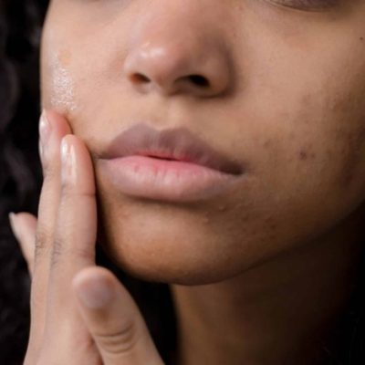 Produto corrige manchas escuras e uniformiza tonalidade - Foto: Pexels