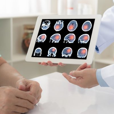 brain cancer or stoke. doctor explaining results check up of brain x-ray scan on digital tablet screen to patient.
