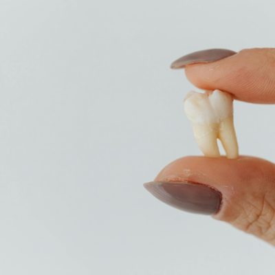 Foto de Photo By: Kaboompics.com: https://www.pexels.com/pt-br/foto/dedos-fundo-branco-close-up-dente-solto-7195444/