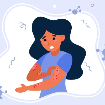 Ilustração de uma mulher com alergia na pele, com manchas vermelhas e coceira, buscando tratamento em Moema e Pompéia para diagnóstico e alívio definitivo.